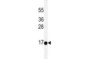 THEM2 antibody western blot analysis in HeLa lysate. (THEM2 抗体)