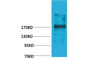 Western Blotting (WB) image for anti-Ectopic P-Granules Autophagy Protein 5 Homolog (EPG5) antibody (ABIN3181525) (EPG5 抗体)