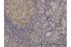 Image no. 2 for anti-Cyclin-Dependent Kinase-Like 4 (CDKL4) (AA 196-295) antibody (ABIN599344) (CDKL4 抗体  (AA 196-295))