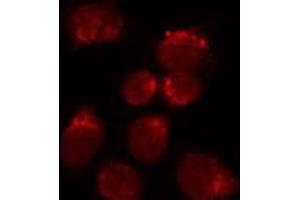 Immunofluorescence (fixed cells) (IF/ICC) image for anti-Nuclear Receptor Subfamily 2, Group F, Member 2 (NR2F2) (N-Term) antibody (ABIN6260046)
