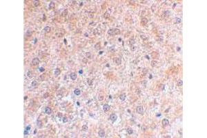 Immunohistochemical staining of mouse liver using TP53INP1 polyclonal antibody  at 2 ug/mL . (TP53INP1 抗体  (C-Term))