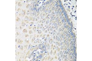 Immunohistochemistry of paraffin-embedded human esophagus using OXCT1 antibody at dilution of 1:100 (40x lens). (OXCT1 抗体)