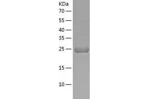 Western Blotting (WB) image for Collagen Triple Helix Repeat Containing 1 (CTHRC1) (AA 31-243) protein (His-IF2DI Tag) (ABIN7122442)
