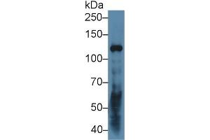 Detection of LAMC2 in Human A431 cell lysate using Polyclonal Antibody to Laminin Gamma 2 (LAMC2) (LAMC2 抗体  (AA 28-196))