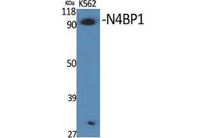 Western Blot (WB) analysis of specific cells using N4BP1 Polyclonal Antibody. (N4BP1 抗体  (Internal Region))