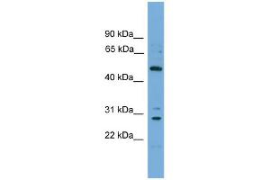 WB Suggested Anti-ULK3 Antibody Titration: 0. (ULK3 抗体  (Middle Region))