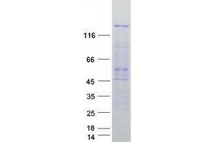 Validation with Western Blot