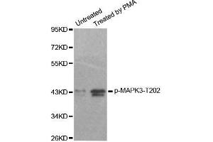 Western blot analysis of extracts from 293 cells, using Phospho-MAPK3-T202 antibody. (ERK1 抗体  (pThr185))