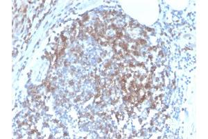 Formalin-fixed, paraffin-embedded human Tonsil stained with CD6 Rabbit Recombinant Monoclonal Antibody (C6/2884R). (Recombinant CD6 抗体)