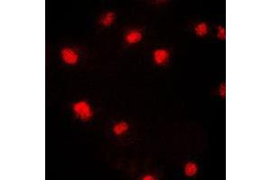 Immunofluorescent analysis of CDC46 staining in HeLa cells. (MCM5 抗体  (N-Term))