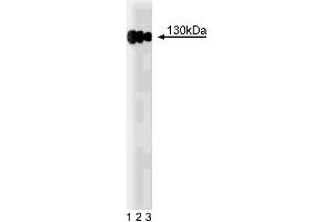 Western blot analysis of CD29 (Integrin beta1) on a A431 cell lysate (Human epithelial carcinoma, ATCC CRL-1555). (ITGB1 抗体  (AA 76-256))
