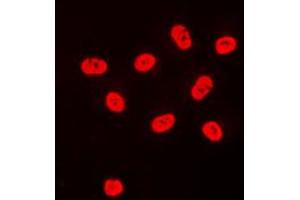 Immunofluorescent analysis of SP3/4 staining in HeLa cells. (Sp3/4 抗体  (C-Term))