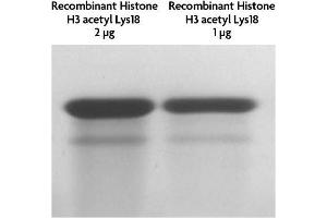 Recombinant Histone H3 acetyl Lys18 tested by SDS-PAGE gel. (Histone 3 Protein (H3) (H3K18ac))