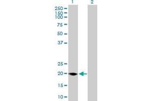 Western Blot analysis of FMO9P expression in transfected 293T cell line by FMO9P MaxPab polyclonal antibody. (FMO9P 抗体  (AA 1-160))