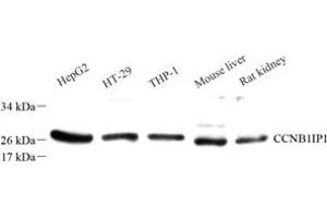 Western blot analysis of Ccnb1ip1 (ABIN7073614) at dilution of 1: 50 (CCNB1IP1 抗体)