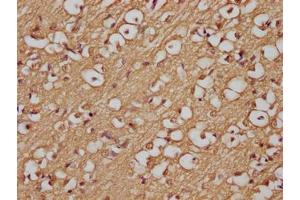 Immunohistochemistry of paraffin-embedded human brain tissue using ABIN7144489 at dilution of 1:200 (APP 抗体)