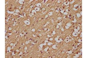 Immunohistochemistry of paraffin-embedded human brain tissue using ABIN7144489 at dilution of 1:200 (APP 抗体)