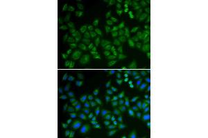 Immunofluorescence analysis of HeLa cells using SMPD1 antibody. (SMPD1 抗体  (AA 70-340))