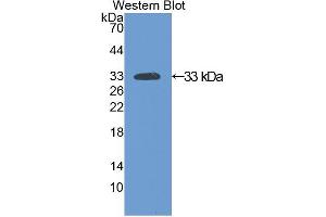 Western blot analysis of recombinant Rat SIRT2. (SIRT2 抗体  (AA 28-303))