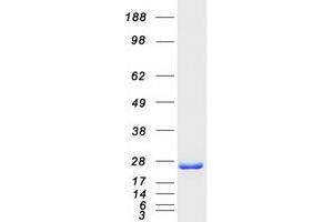 Western Blotting (WB) image for Proteasome (Prosome, Macropain) Activator Subunit 2 (PA28 Beta) (PSME2) protein (Myc-DYKDDDDK Tag) (ABIN2730010)