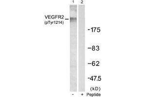 Western blot analysis of extracts from SKOV3 cells using VEGFR2(Phospho-Tyr1214) Antibody(Lane 1) and the same antibody preincubated with blocking peptide(Lane2). (VEGFR2/CD309 抗体  (pTyr1214))