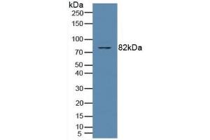 Detection of PKCq in Human Jurkat Cells using Polyclonal Antibody to Protein Kinase C Theta (PKCq) (PKC theta 抗体  (AA 380-634))