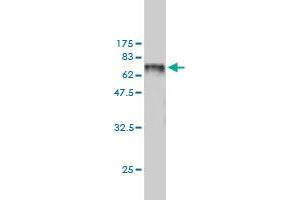 Western Blot detection against Immunogen (78. (SNX25 抗体  (AA 1-483))