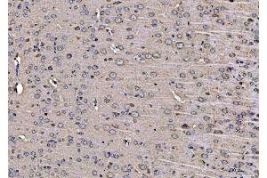 IHC analysis of ARFGAP1 using anti-ARFGAP1 antibody (ABIN4886474). (ARFGAP1 抗体  (AA 1-183))