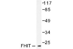 Image no. 2 for anti-Fragile Histidine Triad (FHIT) antibody (ABIN265419) (FHIT 抗体)