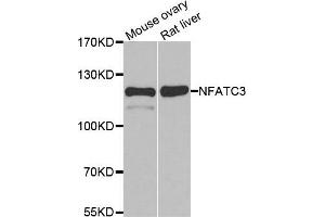 Western blot analysis of extracts of various cell lines, using NFATC3 antibody. (NFATC3 抗体)