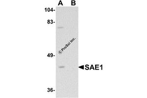 Western Blotting (WB) image for anti-SUMO1 Activating Enzyme Subunit 1 (SAE1) (C-Term) antibody (ABIN1030635) (SAE1 抗体  (C-Term))