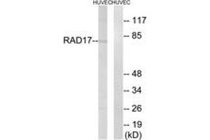 Western blot analysis of extracts from HuvEc cells, using RAD17 (Ab-645) Antibody. (RAD17 抗体  (AA 621-670))