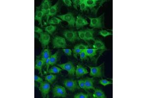 Immunofluorescence (IF) image for anti-Tyrosine-Protein Phosphatase Non-Receptor Type 22 (PTPN22) (AA 1-90) antibody (ABIN1513449)
