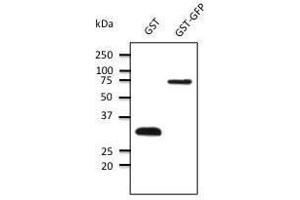 Anti-GST Ab at 1/1000 dilution, 50 ng of protein per Iane, rabbit polyclonal to goat lµg (HRP) at dilution, CEDOC/FCM — NOVA University of Lisbon, Portugal (GST 抗体)