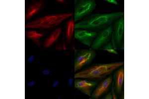 ABIN6260123 and ABIN6279669 staining  cells by IF/ICC.