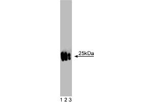 Western blot analysis of MnSOD on a mouse kidney lysate. (SOD2 抗体  (AA 114-220))