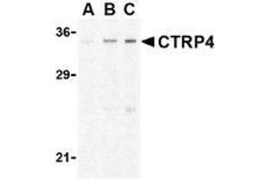 Western blot analysis of CTRP4 in rat brain cell lysate with AP30253PU-N CTRP4 antibody at (A) 1, (B) 2, and (C) 4 μg/ml. (C1QTNF4 抗体  (N-Term))