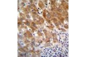 Formalin fixed and paraffin embedded human liver tissue reacted with Fumarylacetoacetase Antibody (N-term) Cat. (FAH 抗体  (N-Term))
