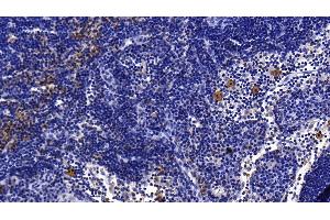 Immunohistochemistry (IHC) image for anti-Interleukin 1 Receptor Accessory Protein (IL1RAP) (AA 65-249) antibody (ABIN7436570)