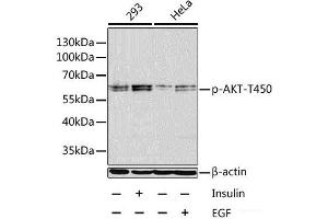 Western blot analysis of extracts of 293 and HeLa cells using Phospho-AKT(T450) Polyclonal Antibody at dilution of 1:1000. (AKT1 抗体  (pThr450))
