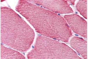 Immunohistochemistry (Formalin-fixed Paraffin-embedded Sections) (IHC (fp)) image for anti-Phosphatidic Acid Phosphatase Type 2 Domain Containing 3 (PPAPDC3) (N-Term) antibody (ABIN605141)