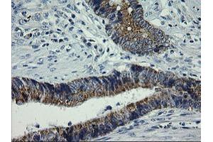 Image no. 2 for anti-Armadillo Repeat Containing 1 (ARMC1) antibody (ABIN1496727) (ARMC1 抗体)