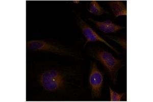 Image no. 1 for anti-Cofilin 1 (CFL1) (Tyr88) antibody (ABIN319381) (Cofilin 抗体  (Tyr88))