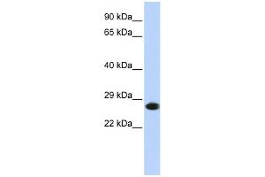 WB Suggested Anti-PSMA2 Antibody Titration: 0. (PSMA2 抗体  (N-Term))