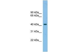 WB Suggested Anti-GPR87 Antibody Titration: 0. (GPR87 抗体  (N-Term))