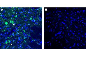 Expression of SLC10A4 in rat dorsal raphe nucleus.