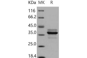 Western Blotting (WB) image for Cathepsin L1 (CTSL1) (AA 1-334) protein (His tag) (ABIN7194684)