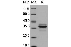 Western Blotting (WB) image for Cathepsin L1 (CTSL1) (AA 1-334) protein (His tag) (ABIN7194684) (Cathepsin L Protein (AA 1-334) (His tag))