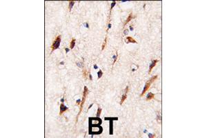 Formalin-fixed and paraffin-embedded human brain tissue reacted with MOBKL1A polyclonal antibody  , which was peroxidase-conjugated to the secondary antibody, followed by DAB staining . (MOBKL1A 抗体  (C-Term))
