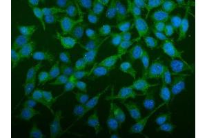 IF analysis of SEC14L3/TAP2 using anti-SEC14L3/TAP2 antibody (ABIN7601623).